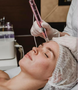 Clínica de Preenchimento Facial em Ipuiúna