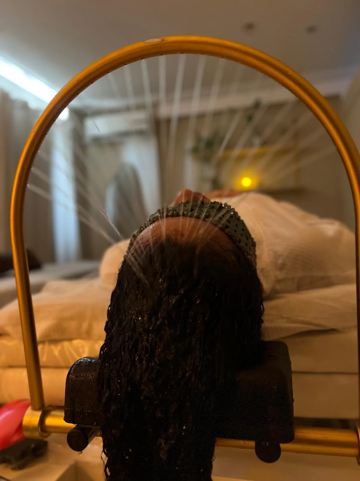 Tratamento para Alopecia Androgenética em São Caetano do Sul, SP